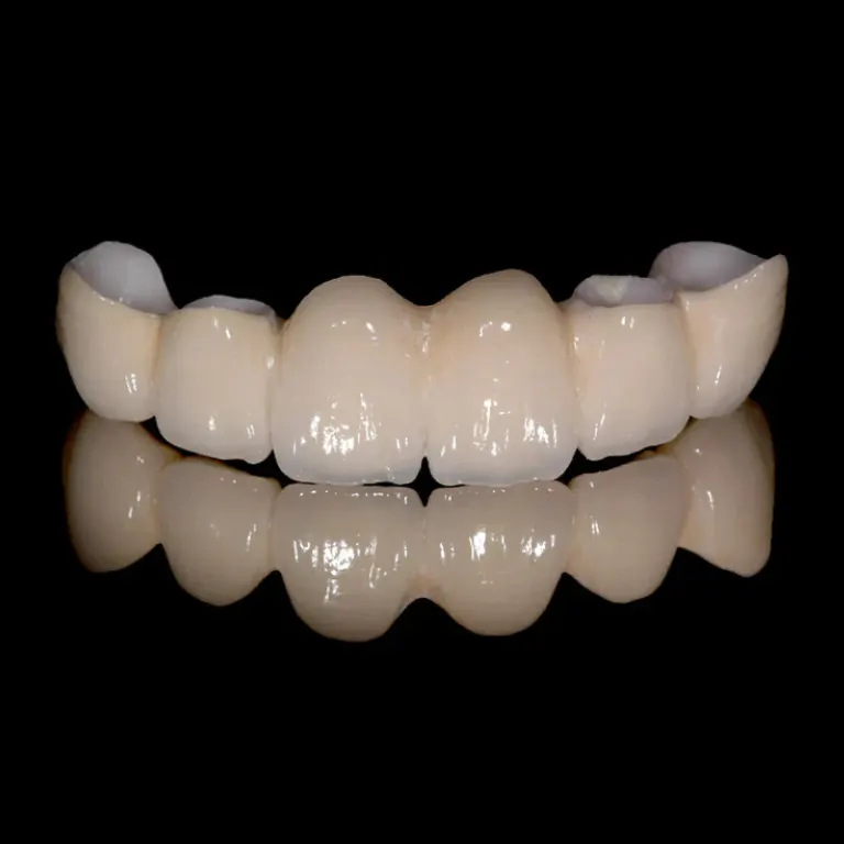 High translucent zirconia bridge