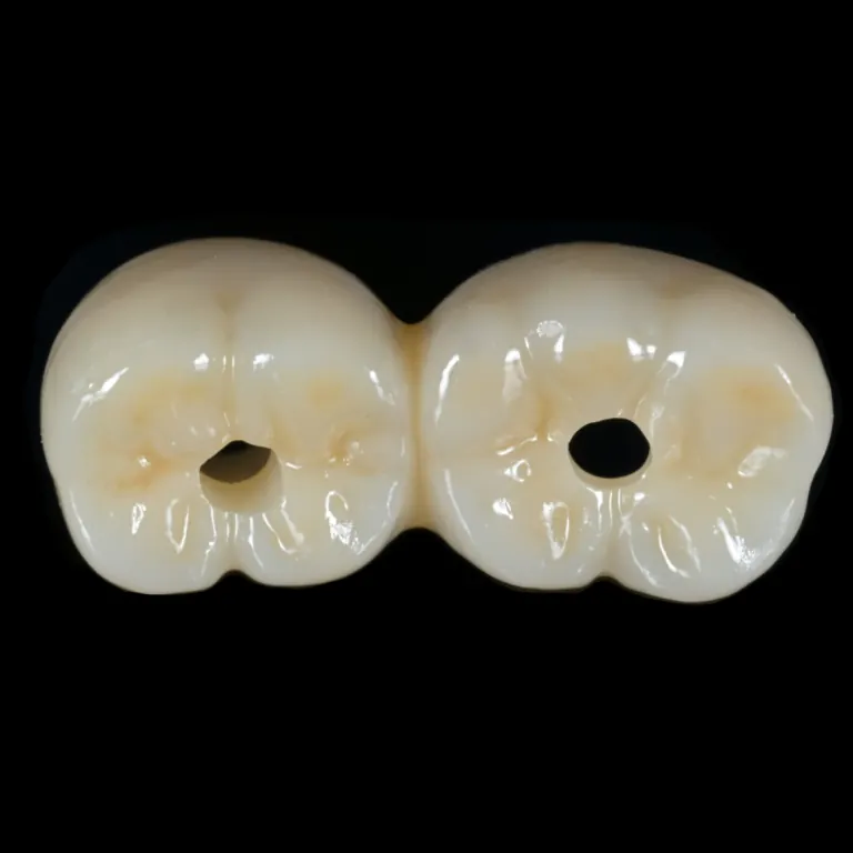 Monolithic zirconia bridge