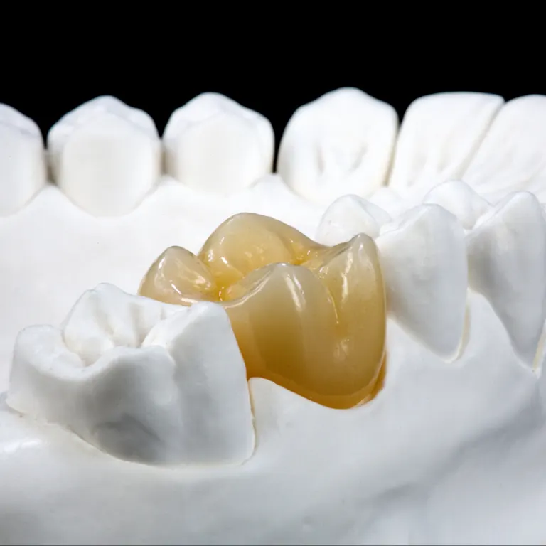 Multi-layer zirconia crown