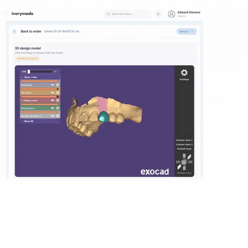 Ivorymade design review screen showing a 3D dental model.